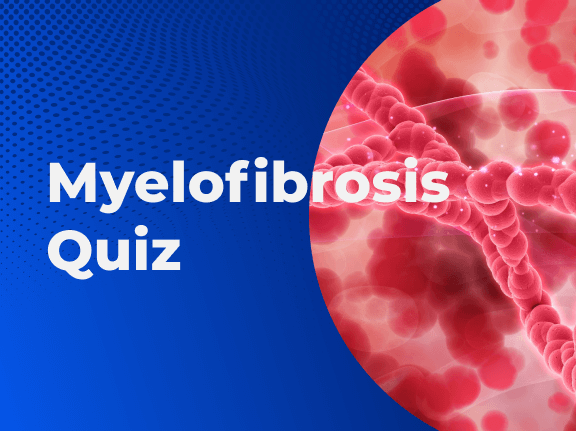 Myelofibrosis Quiz