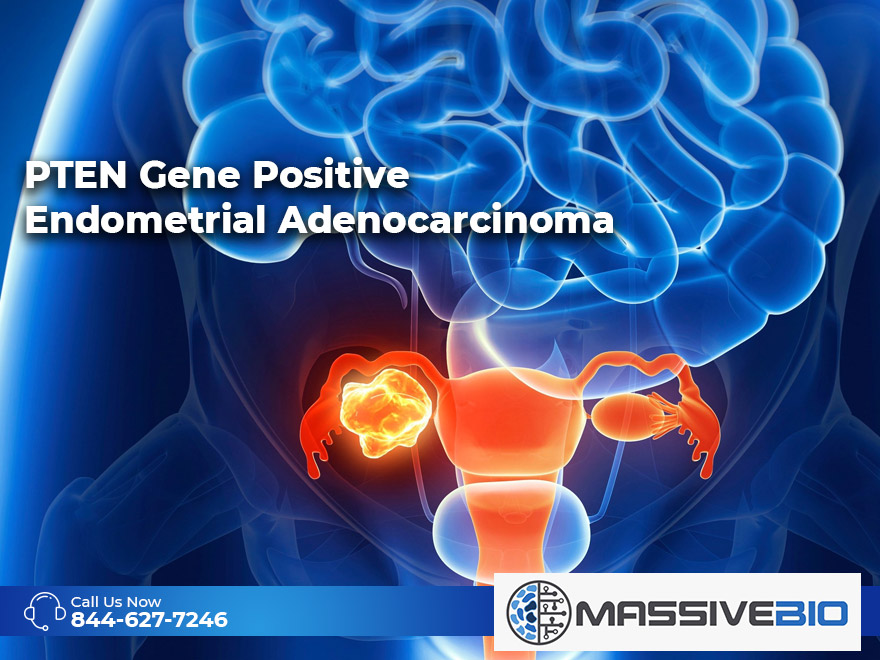 PTEN Gene Positive Endometrial Adenocarcinoma