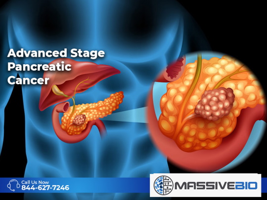 Advanced Stage Pancreatic Cancer