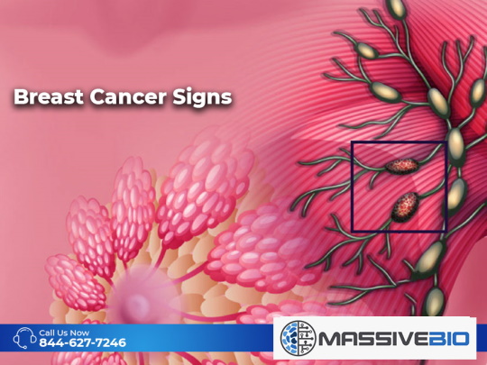 Breast Cancer Signs