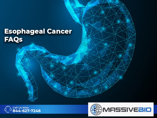 Esophageal Cancer FAQs