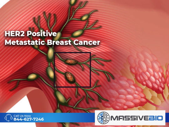 HER2 Positive Metastatic Breast Cancer