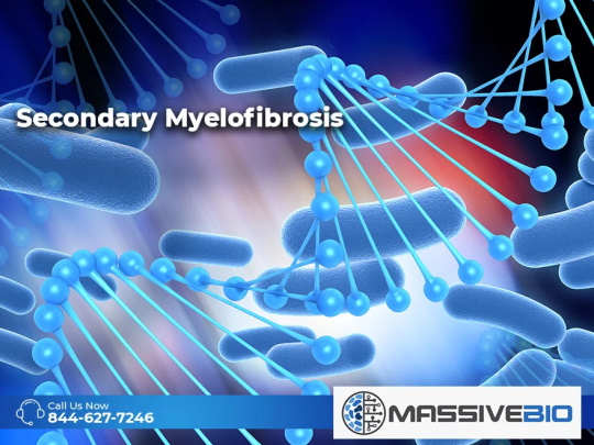 Secondary Myelofibrosis