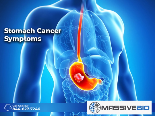Stomach Cancer Symptoms
