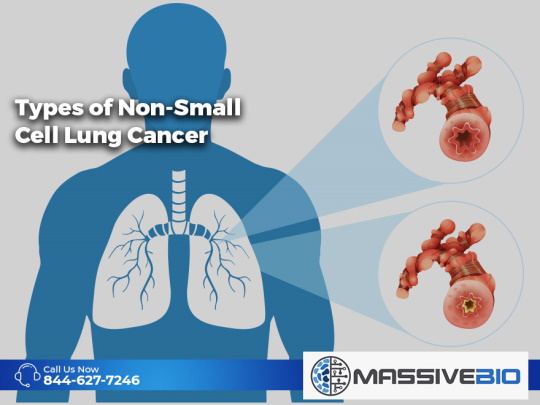 Types of Non-Small Cell Lung Cancer