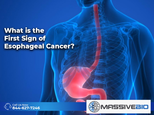 What is the First Sign of Esophageal Cancer?
