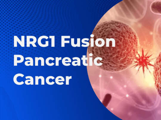 NRG1 Fusion Pancreatic Cancer