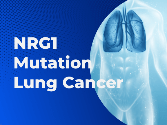 NRG1 Mutation Lung Cancer