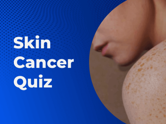 Skin Cancer Quiz