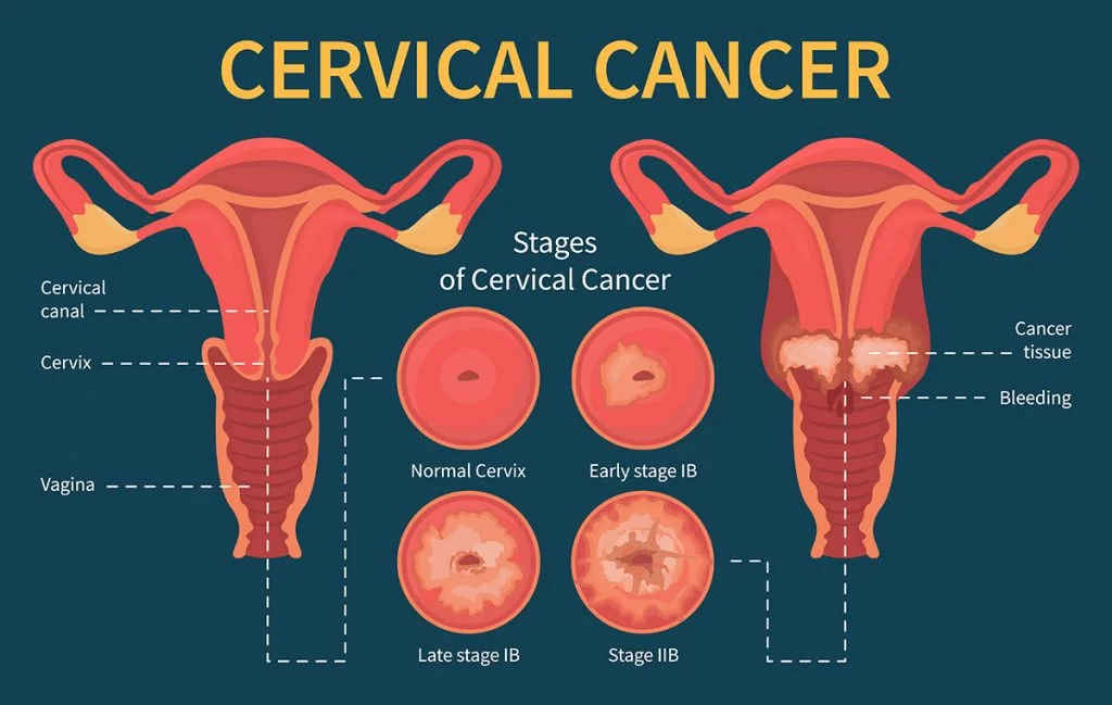 The Cervix - Structure - Function - Vascular Supply - TeachMeAnatomy