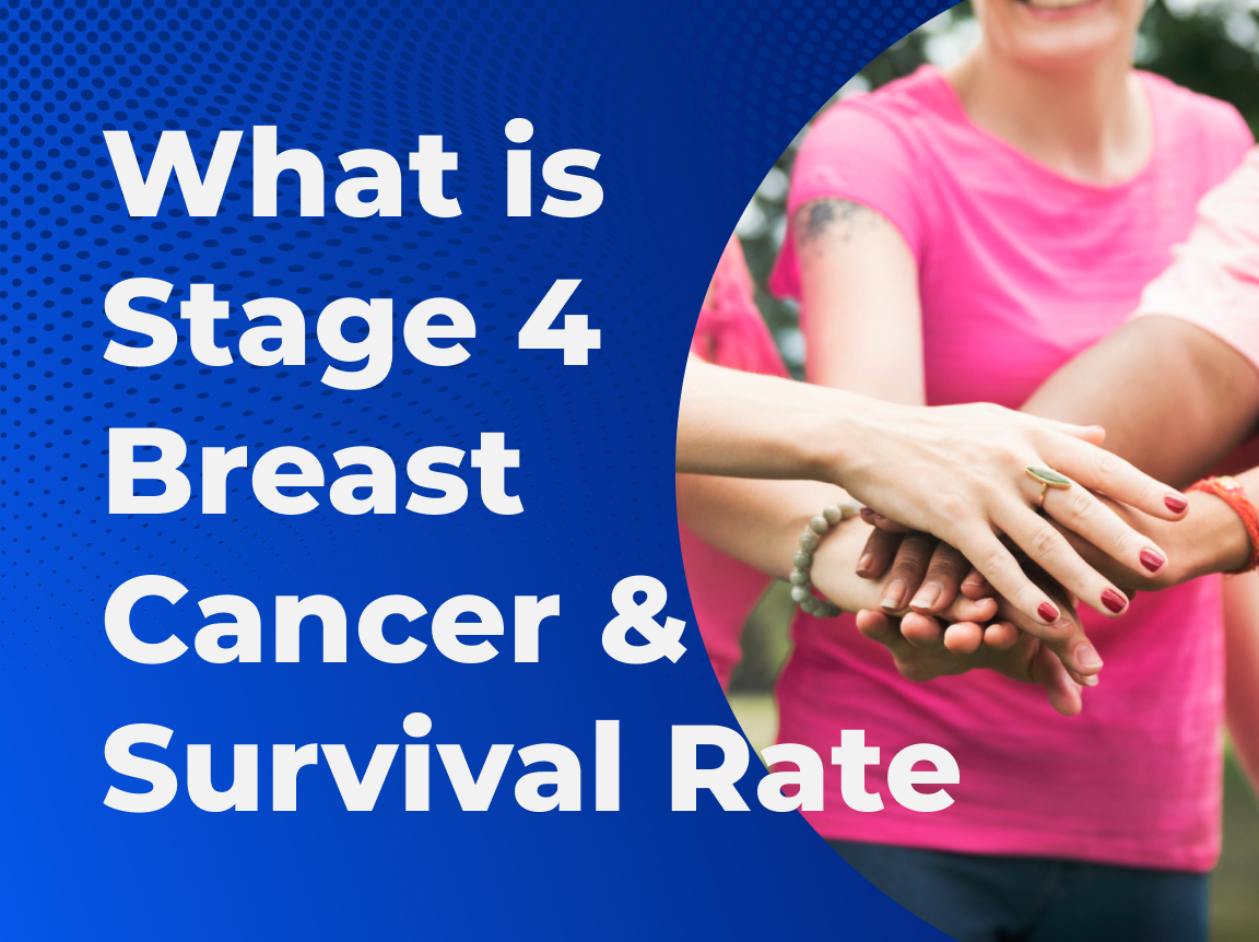 What is stage 4 breast cancer