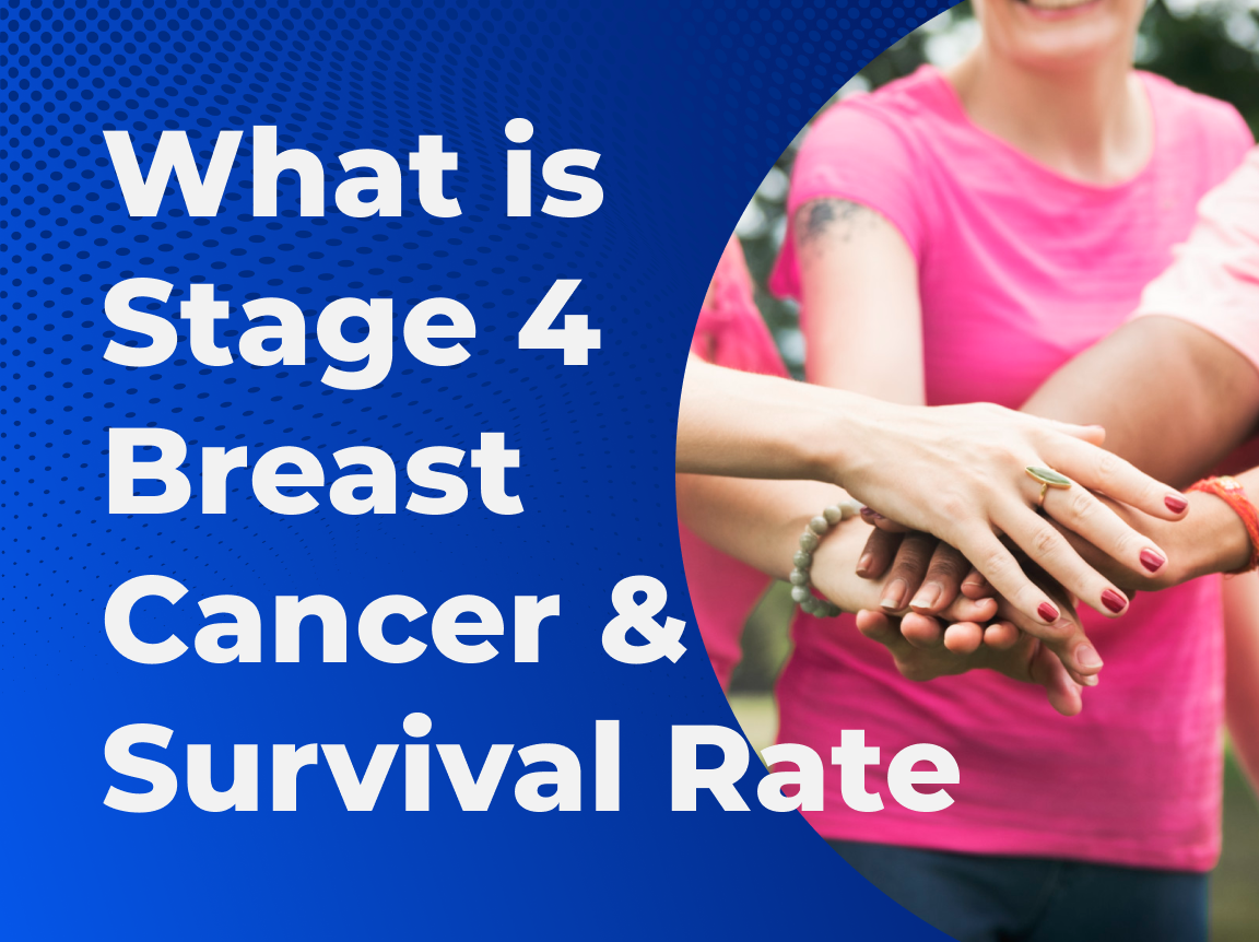 what-is-stage-4-breast-cancer-survival-rate-massive-bio