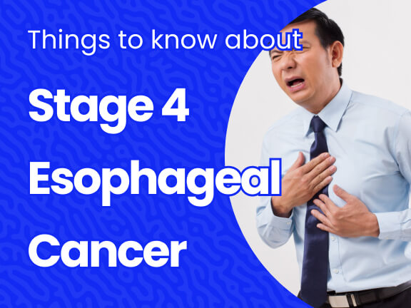 Stage 4 Esophageal Cancer
