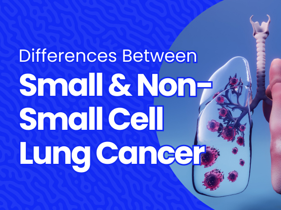 Differences Between Small Cell and Non-Small Cell Lung Cancer
