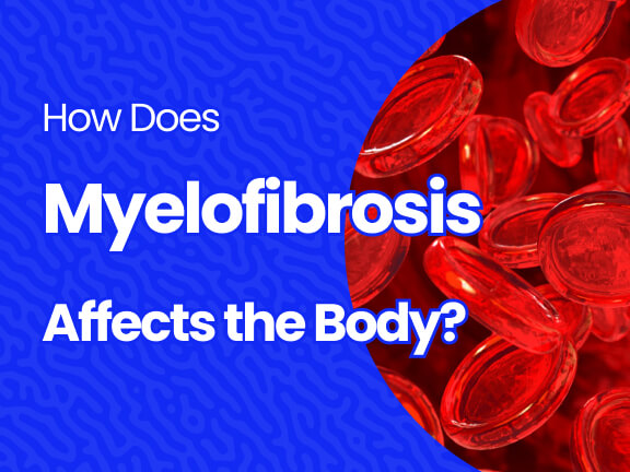 Effects of Myelofibrosis