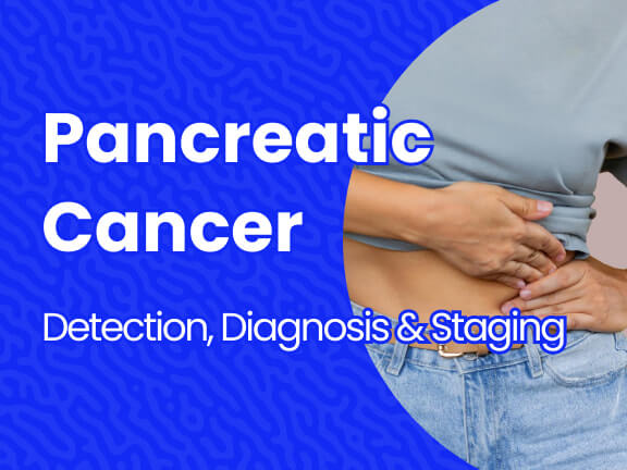 Pancreatic Cancer Detection Diagnosis And Staging Massive Bio 6056