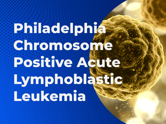 Philadelphia Chromosome Positive Acute Lymphoblastic Leukemia