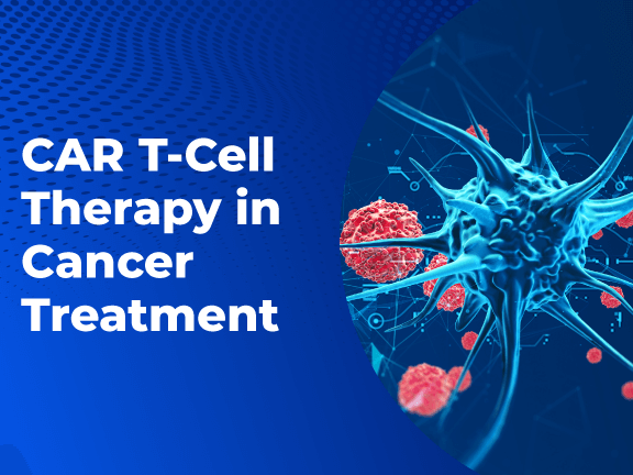 CAR T-Cell-Therapy in Cancer Treatment
