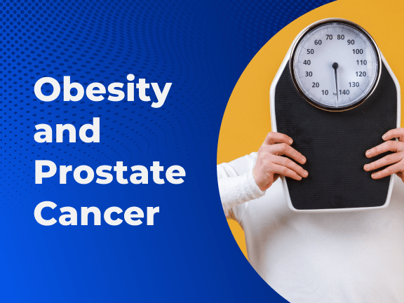 Obesity Prostate Cancer