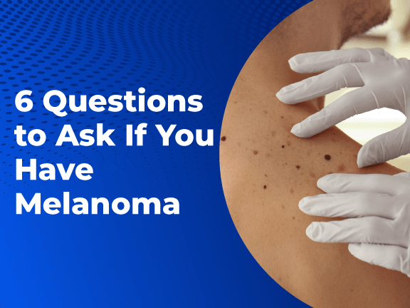Six Questions to Ask If You Have Melanoma